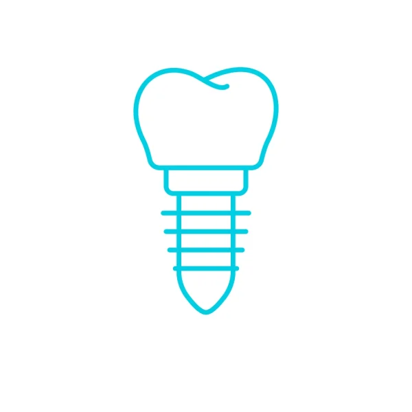 implant implant